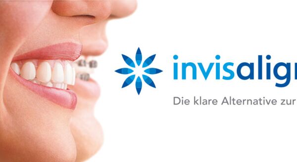 Invisalign